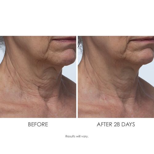 Lift & Smooth Neck Firming Treatment