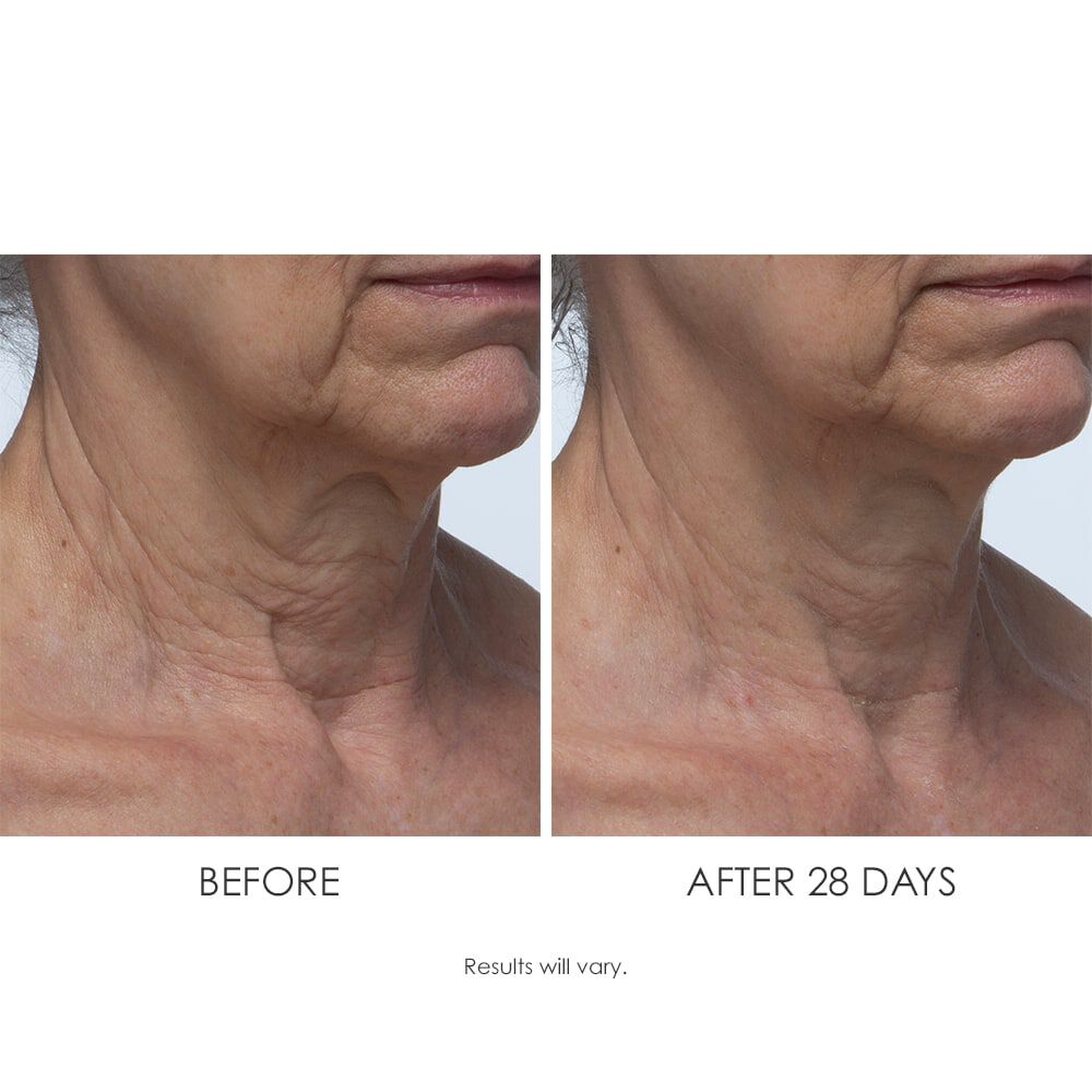 Lift & Smooth Neck Firming Treatment from Crepe Erase